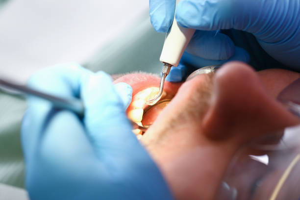 Best Emergency Orthodontic Repairs in Mount Pleasant, TX